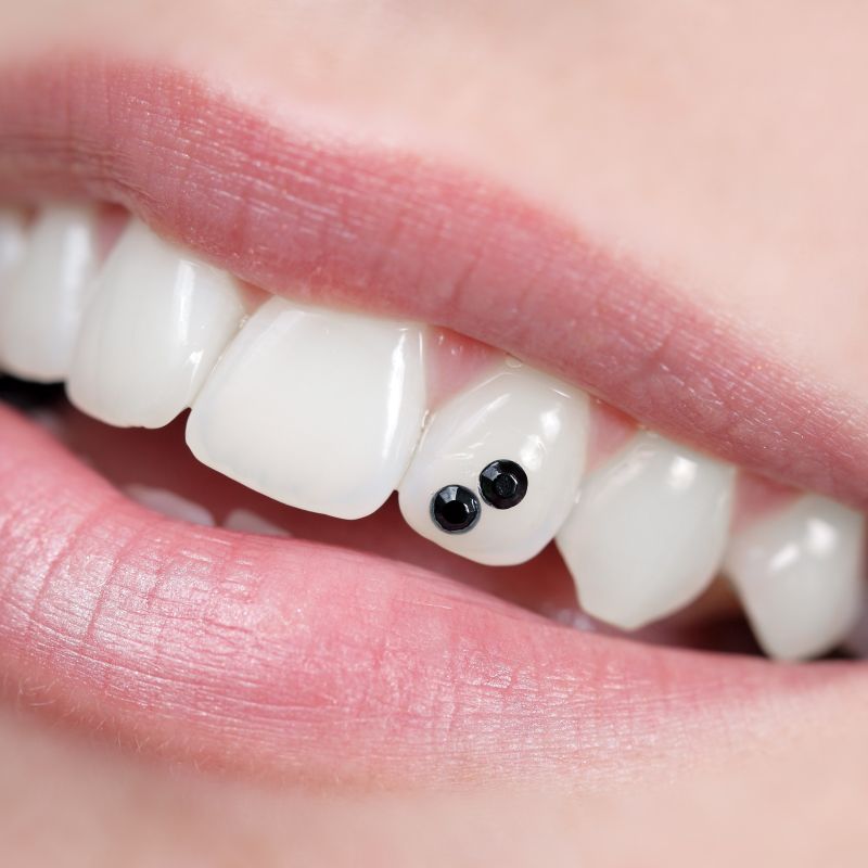 Dental Jewelry – Tooth Bling