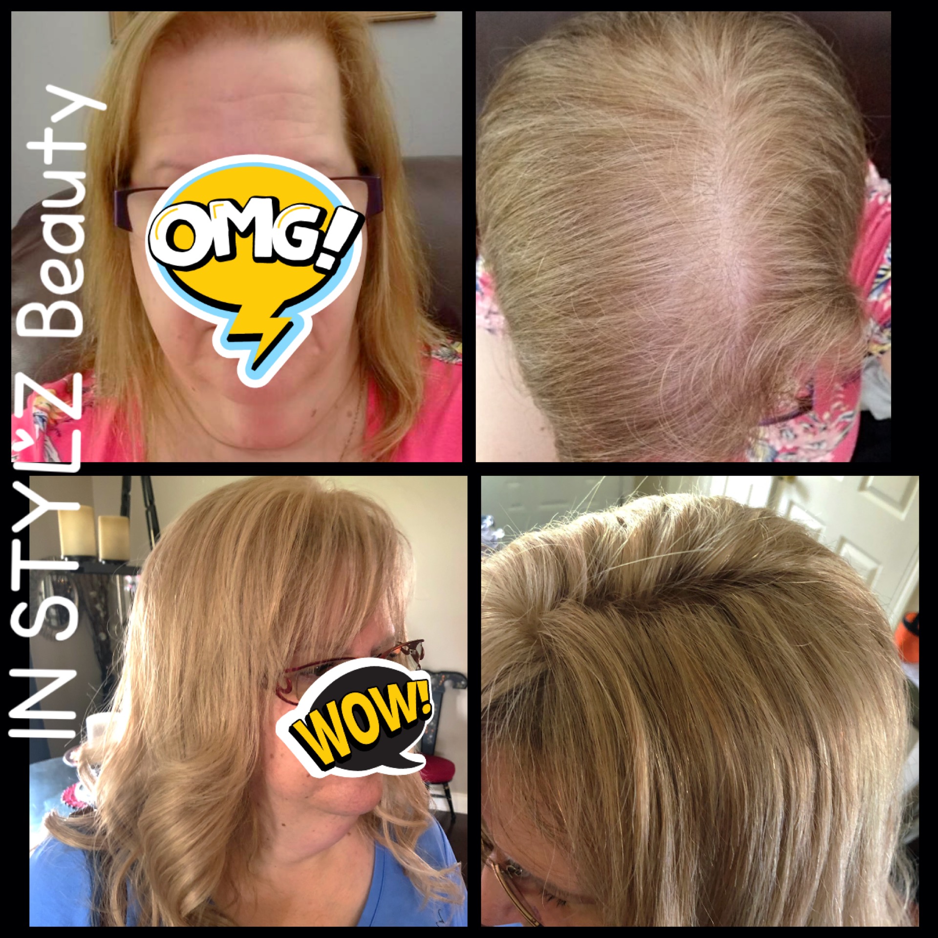 Hair topper