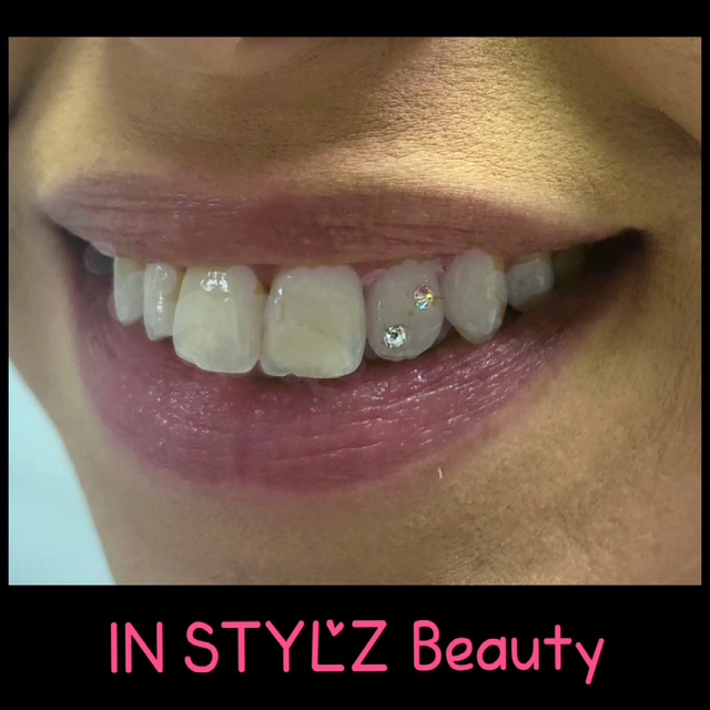 Dental Jewelry – Tooth Bling