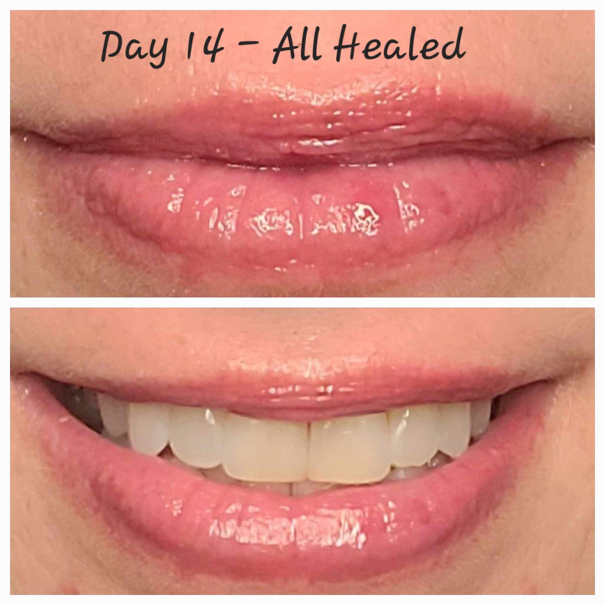 Permanent Makeup