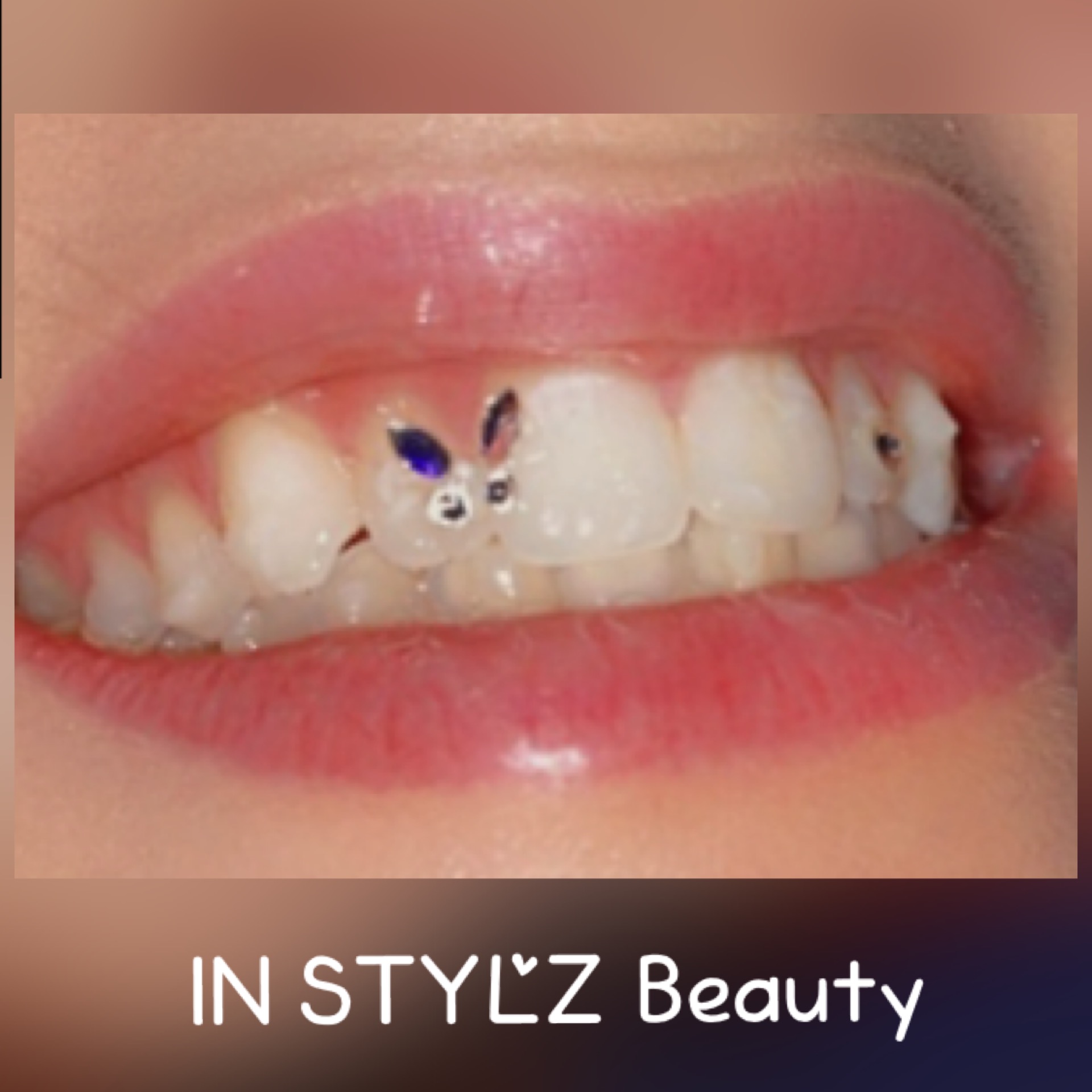 Dental Jewelry – Tooth Bling