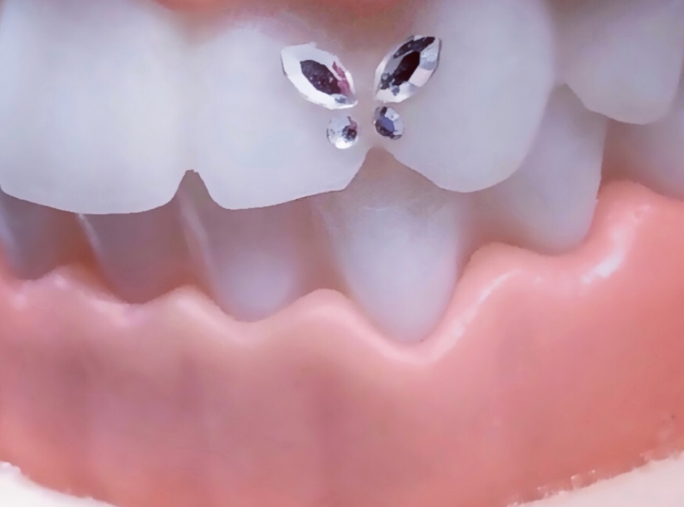 Dental Jewelry – Tooth Bling