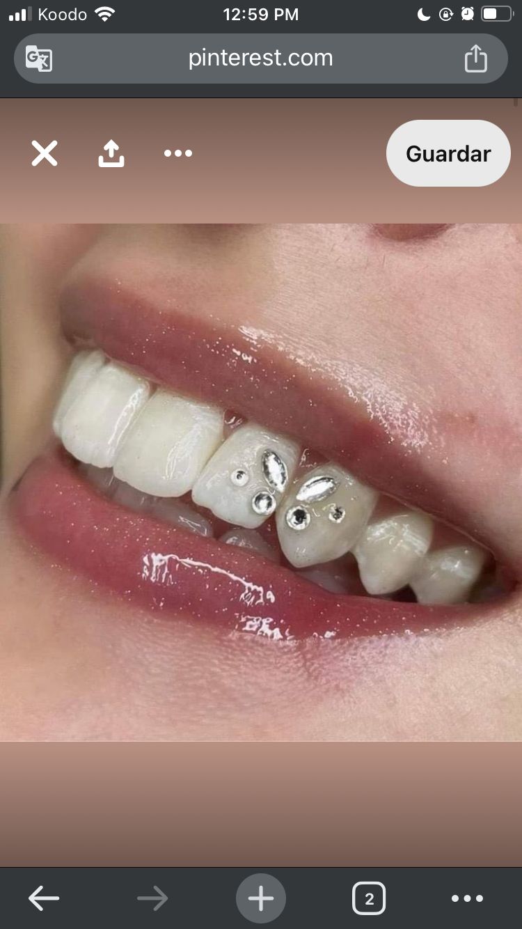 Dental Jewelry – Tooth Bling