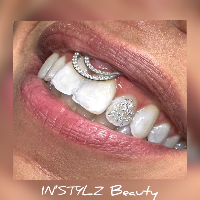 Dental Jewelry – Tooth Bling