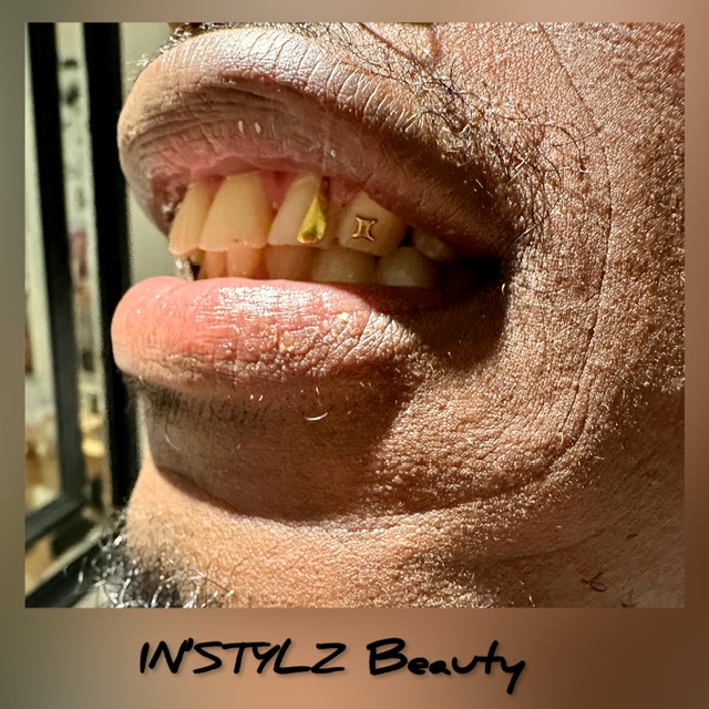 Dental Jewelry – Tooth Bling